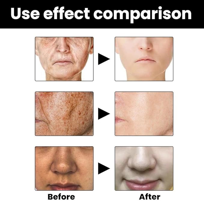 Vivilexio™ Melanin Corrector Serum (Pack of 2)