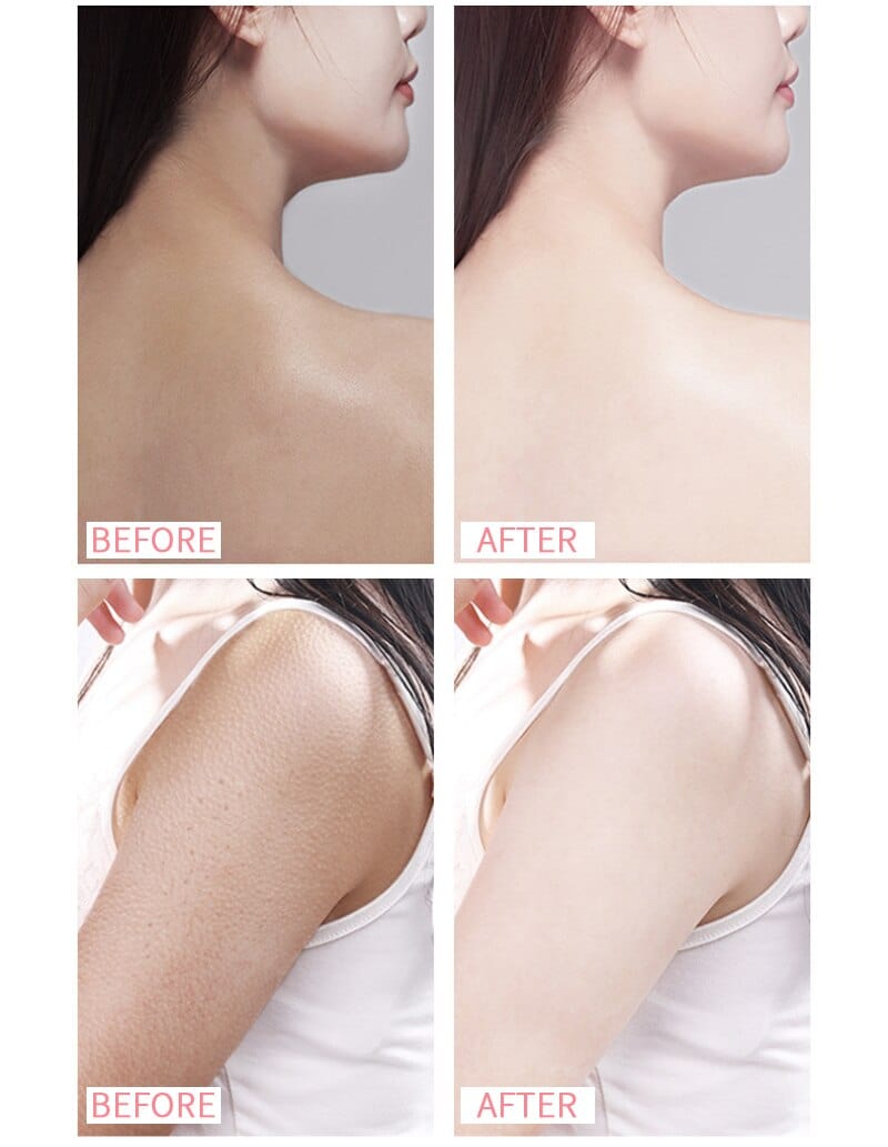 SkinLumy™ Exfoliating Whitening Cream (Pack of 2)